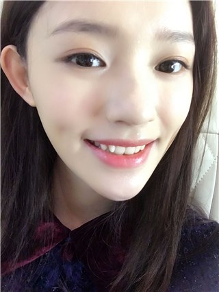 拿掉牙模！林允晒自拍露小尖牙 暴瘦现尖下巴