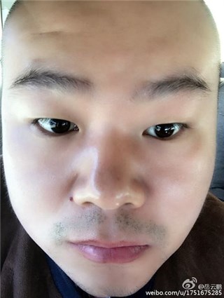 岳云鹏晒美颜大头照 虽然躲过了昨天……