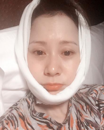 海清为瘦脸深夜绑毛巾网友:小心捂出痱子