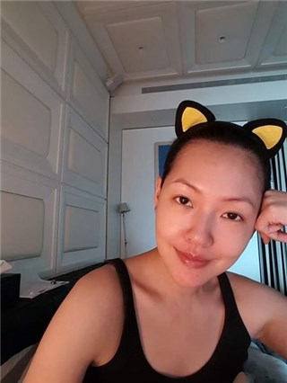 鼻子不歪了！小S终於摆正鼻梁