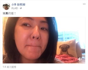 小S将拍重要杂志封面 脸上却长了一个大痘痘