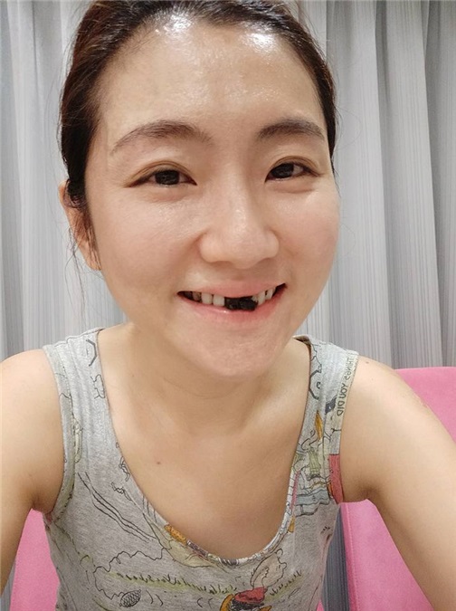 实习崴:Selina吃蛋糕 竟吃到缺牙