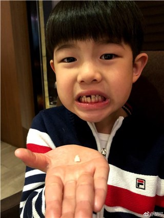 安吉换牙变“豁牙吉” 胡可晒照纪念笑侃：有点儿漏风