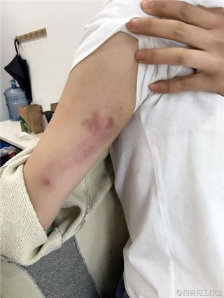 图片说明