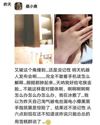 郑爽自爆在家撞伤了眼睛 第二天带伤出席活动超敬业