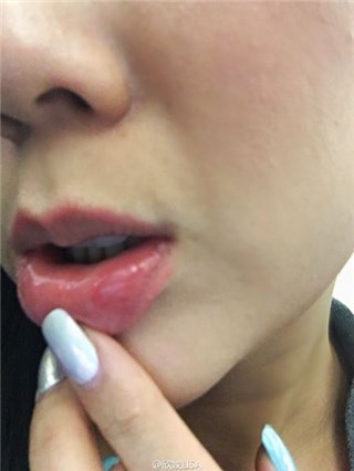 图片说明